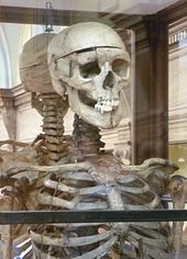 170px-William_Burke_s_skeleton